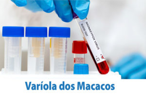 Leia mais sobre o artigo Varíola dos Macacos